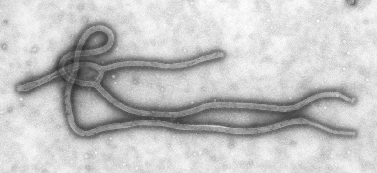 Konžská Ebola má 598 případů a 115 obětí. USA žádají od Evropy uzávěry před MS, Belgie i vědci to odmítají jako nepřiměřené